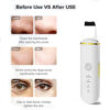 Ultrasonic Skin Scrubber USB Plug Facial Cleansing Blackhead Remover Face Cleaner Machine Skin Care Acne Massager Tools